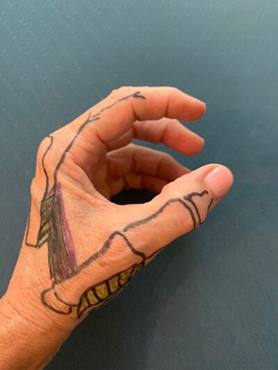 A person's hand shown from the thumb side with bones drawn on it in black marker.